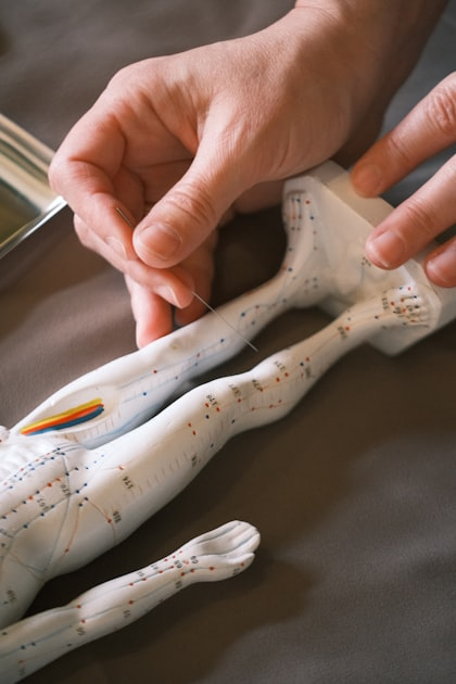 Understanding Acupuncture Benefits